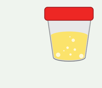 Suboxone (Buprenorphine) Urine Drug Test Online